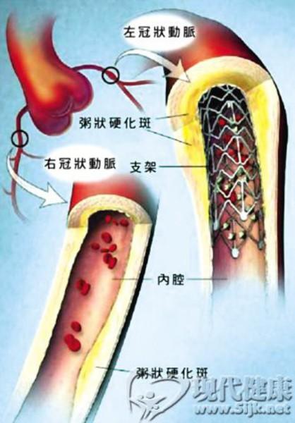 “兵马俑景区外停车收费混乱‘澳门新葡澳京’